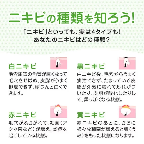 [ROHTO] Mentholatum Acnes Medicinal Cream Face Wash 130g