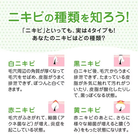 [ROHTO] Mentholatum Acnes Medicinal Cream Face Wash 130g